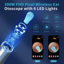 ear-wax-removal-ear-cleaner-with-hd-ear--2.jpg