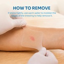 conkote-hydrocolloid-wound-dressings-2-x-6.jpg