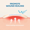 conkote-hydrocolloid-wound-dressings-2-x-4.jpg
