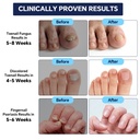 toenail-fungus-treatment-extra-strength--3.jpg