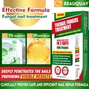 toenail-fungus-treatment-extra-strength--2.jpg