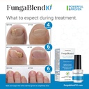 fungablend-10-antifungal-medication-1-to-3.jpg