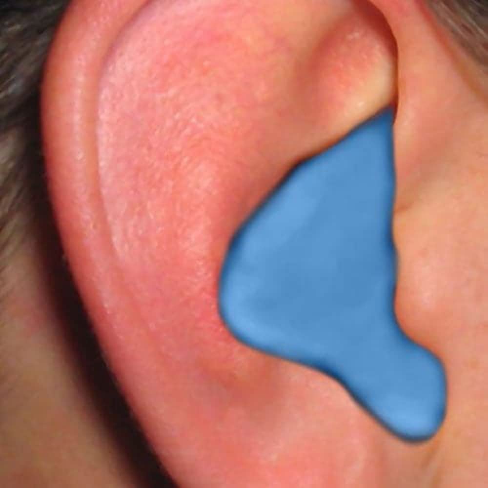 radians-custom-molded-earplugs-3.jpg