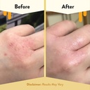 eczema-honey-nut-free-original-skin-soot-4.jpg