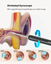 bebird-r1-ear-wax-removal-tool-ear-clean-6.jpg