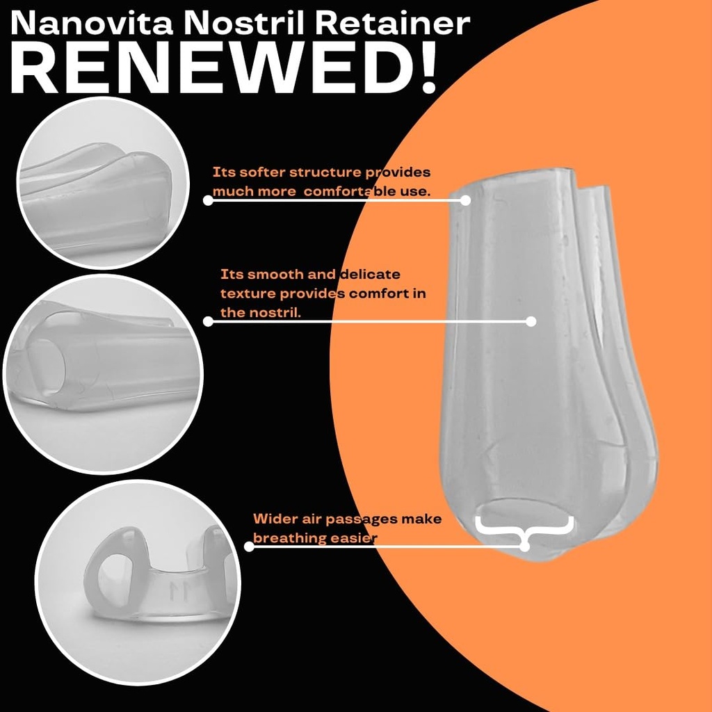nostril-retainer-nostril-shaping-after-s-2.jpg