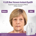 beverly-hills-v-lift-instant-eye-lift-an-3.jpg