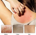 dermatitis-inflammation-and-rashes-body--3.jpg