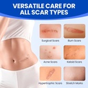 silicone-scar-sheets-surgical-tape-16x12-3.jpg