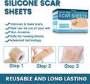silicone-scar-sheets-2-rolls-medical-gra-3.jpg