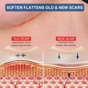 silicone-scar-sheets-for-breast---8-pack-2.jpg