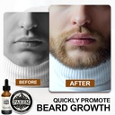 5-piece-beard-grooming-kit-for-men-inclu-5.jpg