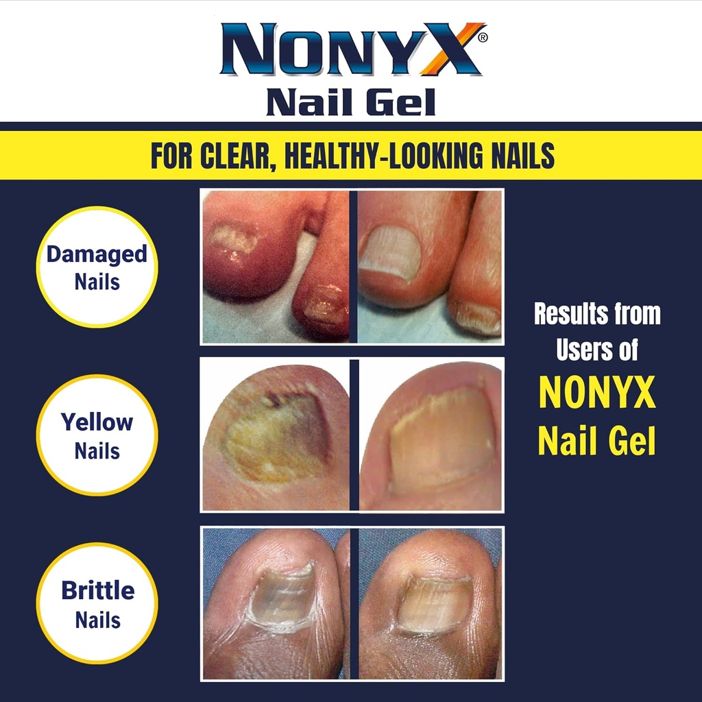 nonyx-fungal-nail-clarifying-gel-clinica-5.jpg