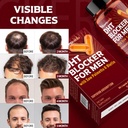 dht-blocker-for-men-hair-growth-suppleme-6.jpg
