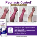 triderma-psoriasis-control-face-body-cre-2.jpg
