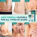 silicone-scar-gel-for-stretch-mark-100-s-6.jpg