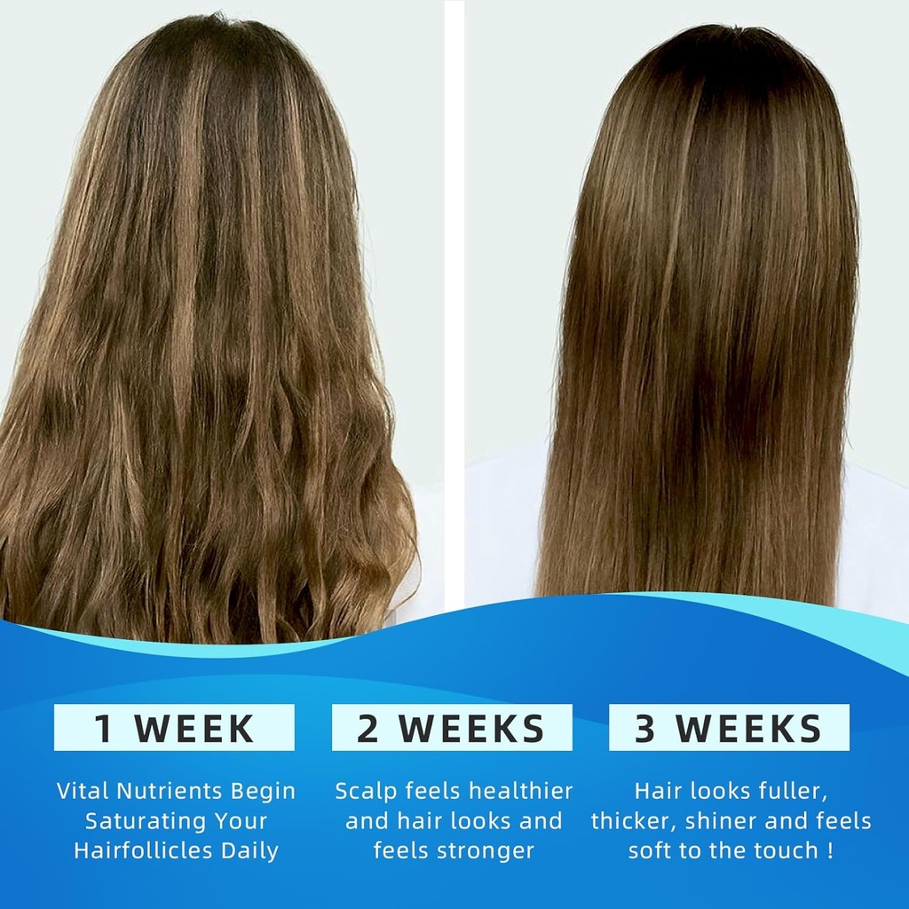 Sugar Free Collagen Peptides Gummies for Women Men, 1500mg Collagen Types I,II,III,V,X, Plus 5000mcg Biotin & Multi Vitamins for Healthy Skin Hair Nails, Immune Digestion Bone Support 6