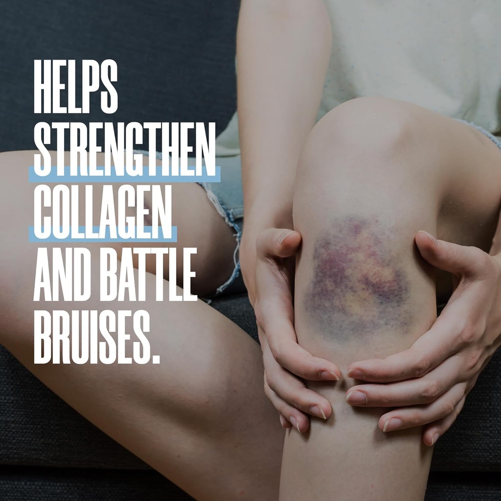 ZAX'S Bruise Vitamin Pharmacist Developed Bruising Supplements Potent Bruising Swelling Reducer, Zinc, Vitamin K, D3, Ascorbic Acid, Citrus Bioflavonoids, 60 Caps, Combine Arnica Bruise Cream 4