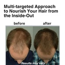 Dr. Steven Gabriel Natural DHT Blocker for Women and Men - Hair Growth Supplement with Saw Palmetto, Stinging Nettle, Pygeum Bark, Pumpkin Seed Oil Capsules (60 Caps) 2