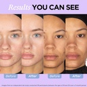 ZitSticka Vitamin Acne Supplement for Cystic Acne w/ 30 Natural Caps for Women and Men, Supplements for Hormonal Support, Skin Clarity, Dark Spots - Dermatologist Tested (After Hours Ceramides) 5