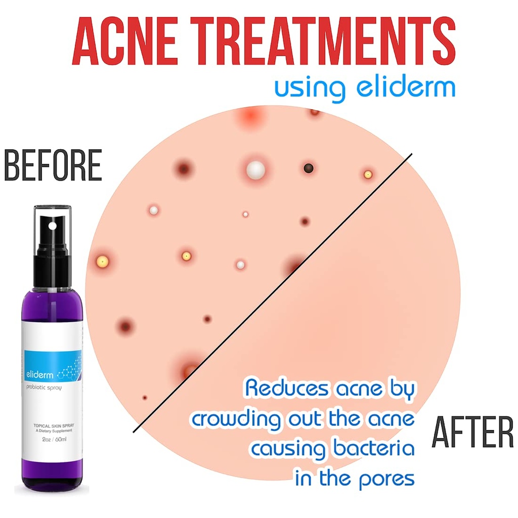topical-probiotic-spray-for-skin-13-stra-4.jpg