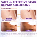 silicone-scar-sheets-silicone-scar-tape--5.jpg