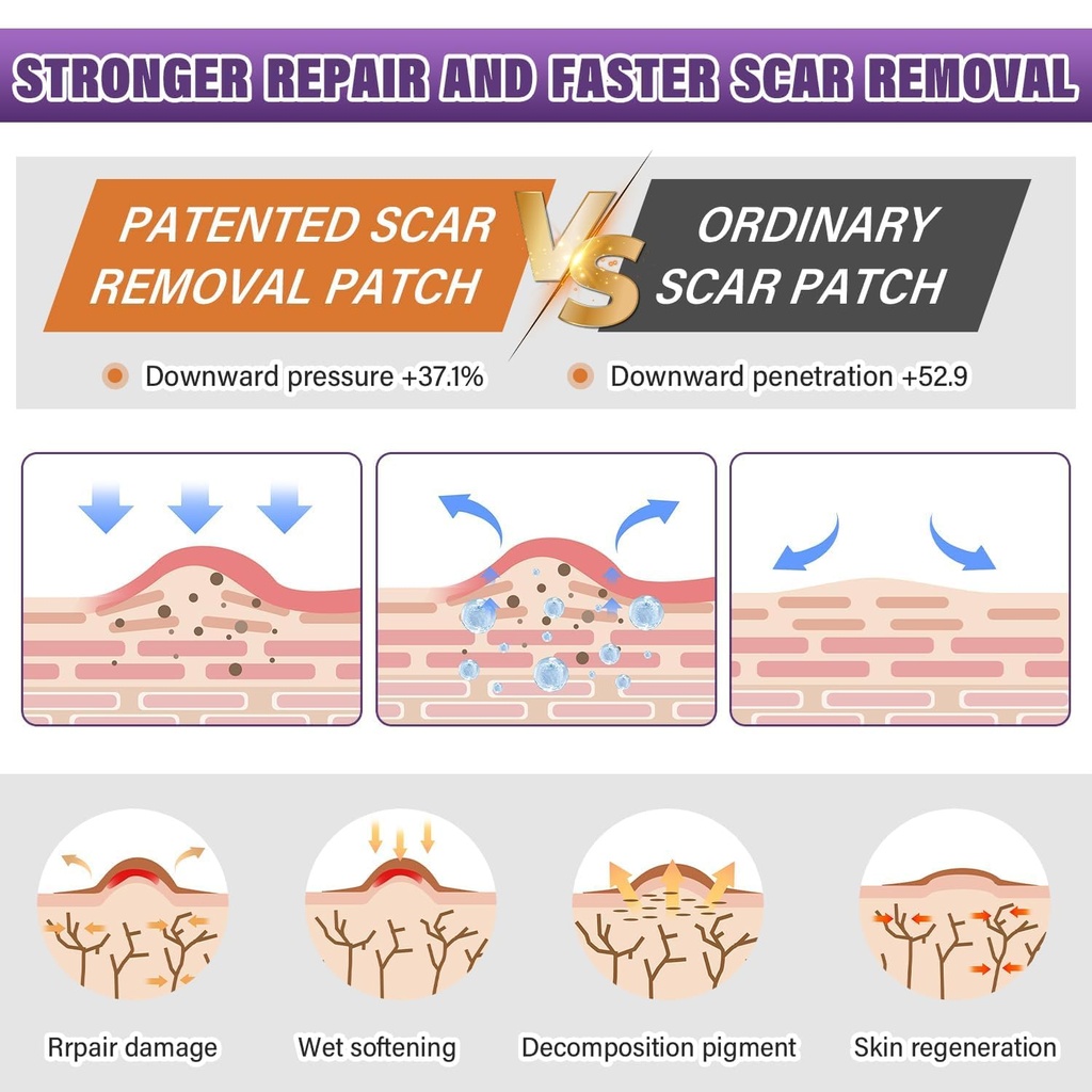 silicone-scar-sheets-silicone-scar-tape--3.jpg