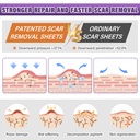 silicone-scar-sheets-silicone-scar-tape--3.jpg