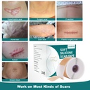 silicone-scar-sheets-1-6-x-158-roll-4m-s-2.jpg
