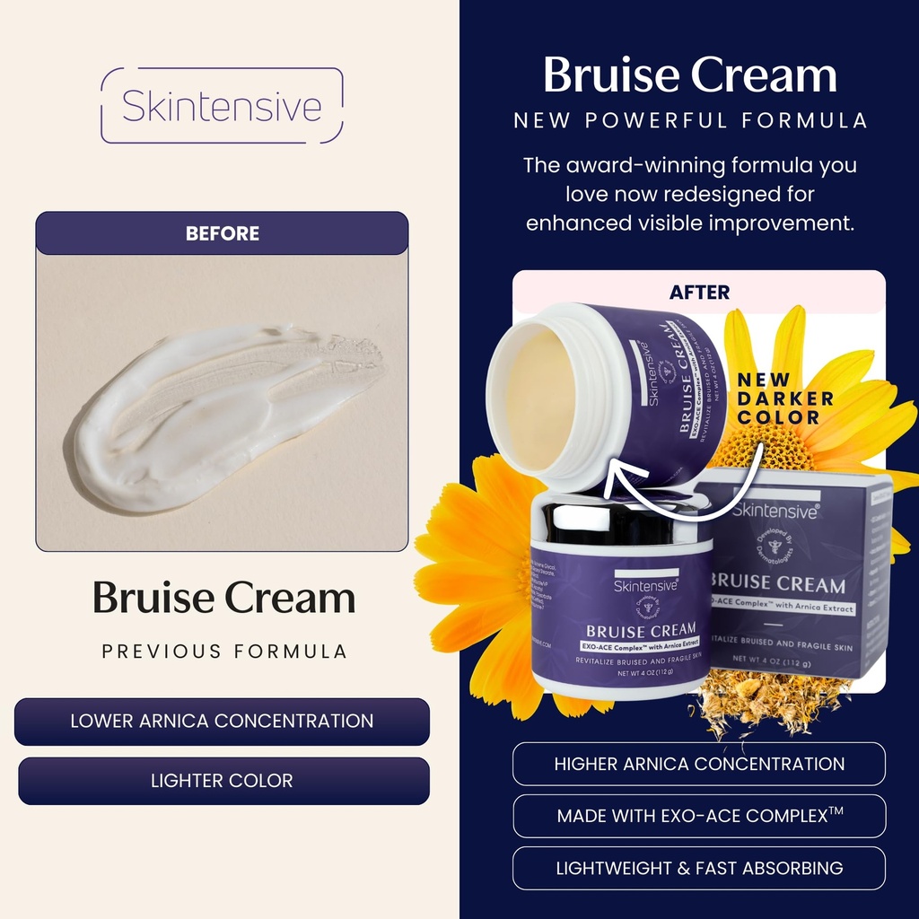 skintensive-arnica-bruise-cream-for-thin-2.jpg