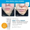 clinically-tested-dermacalm-sos-therapy--4.jpg