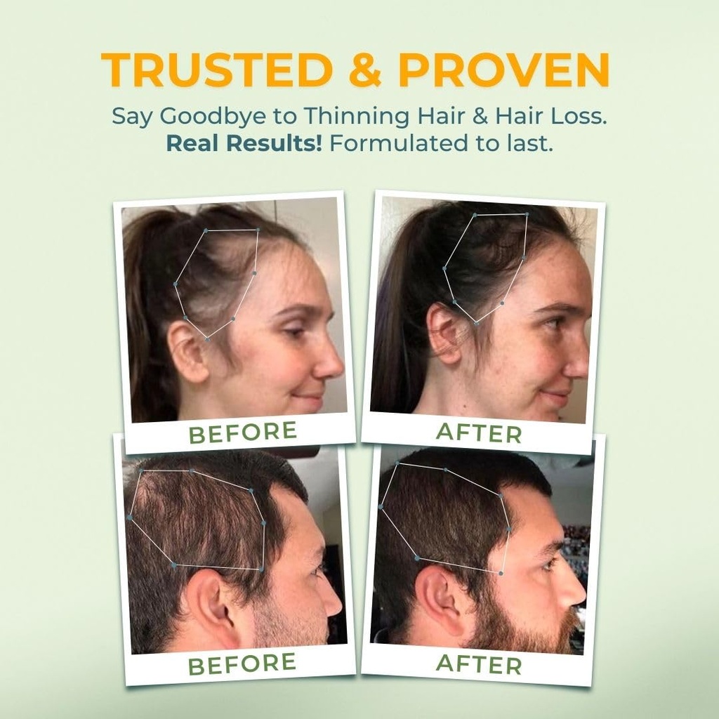 vital-nutritive-vital-hair-complex-bioti-6.jpg