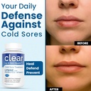 lysine-cold-sore-treatment-for-lips-with-5.jpg