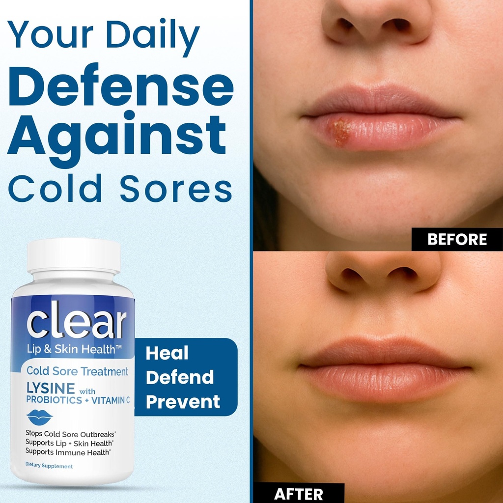 lysine-cold-sore-treatment-for-lips-with-5.jpg