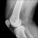 lindberg-joint-support-supplement-for-me-6.jpg