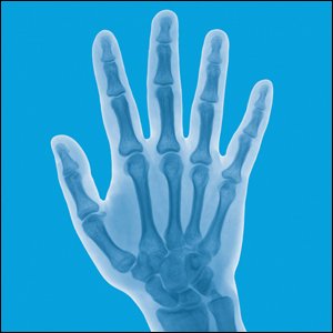 lindberg-joint-support-supplement-for-me-4.jpg