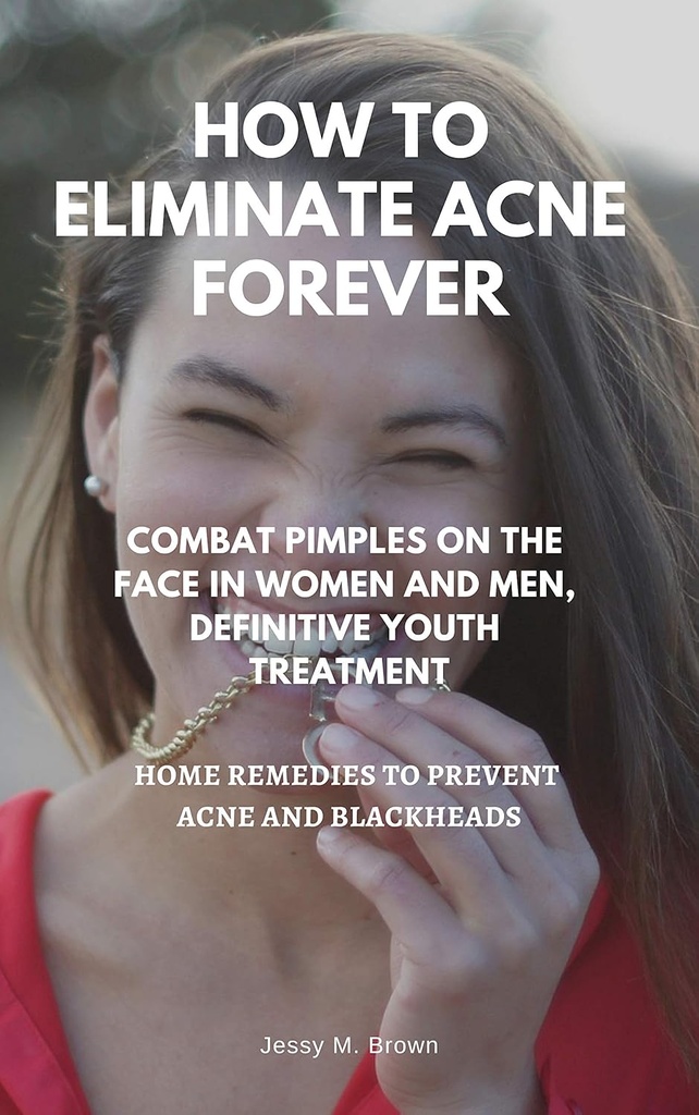 HOW TO ELIMINATE ACNE FOREVER : COMBAT PIMPLES ON THE FACE IN WOMEN AND MEN, DEFINITIVE JUVENILE TREATMENT, HOME REMEDIES TO PREVENT ACNE AND BLACKHEADS