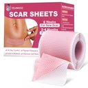 Silicone Scar Sheets,Silicone Scar Tape για χειρουργικές ουλές,C-τμήμα,Tummy Tuck,Keloid Bump Αφαίρεση, Ταινία προσώπου για ρυτίδες Διανυκτέρευση (1.6"X 59" Roll-1.5M-Pigment Μείωση-Pink)