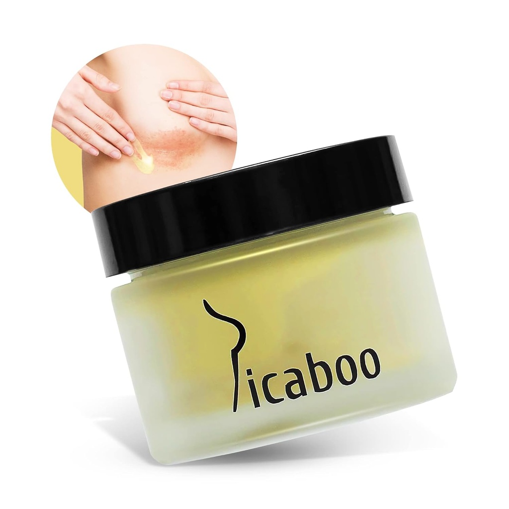 Κάτω από το στήθος και Cleavage Rash Cream, το στήθος Chafing, Itch Relief, Chafing Relief, Made with Matcha Green Tea and Pure Essential Oils, 1 oz.