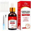 Fungus toe νυχιών θεραπείες για toenail: Nail Fungus θεραπεία για τα νύχια – Επιπλέον δύναμη, γρήγορη-ενεργώντας λύση για ραγισμένα, κατεστραμμένα, αποχρωματισμένα νύχια