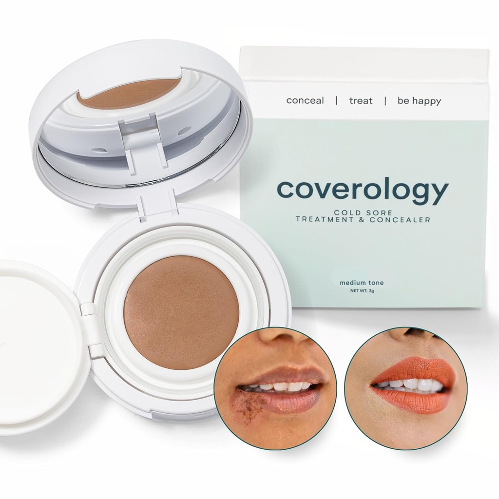 Coverology Cold Sore treatment & Cold Sore Concealer - Η καλύτερη πλήρη κάλυψη Cold Sore makeup για να βοηθήσει στη μεταμφίεση και Soothe - Medium