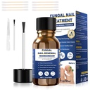 Toenail Fungus Treatment,Foot Fungus Treatment Extra Strength,Fungus Nail Treatment, Toe Nail Fungus Treatments For Fungi Nail yellow toenail treatment(1fl oz/30ml)