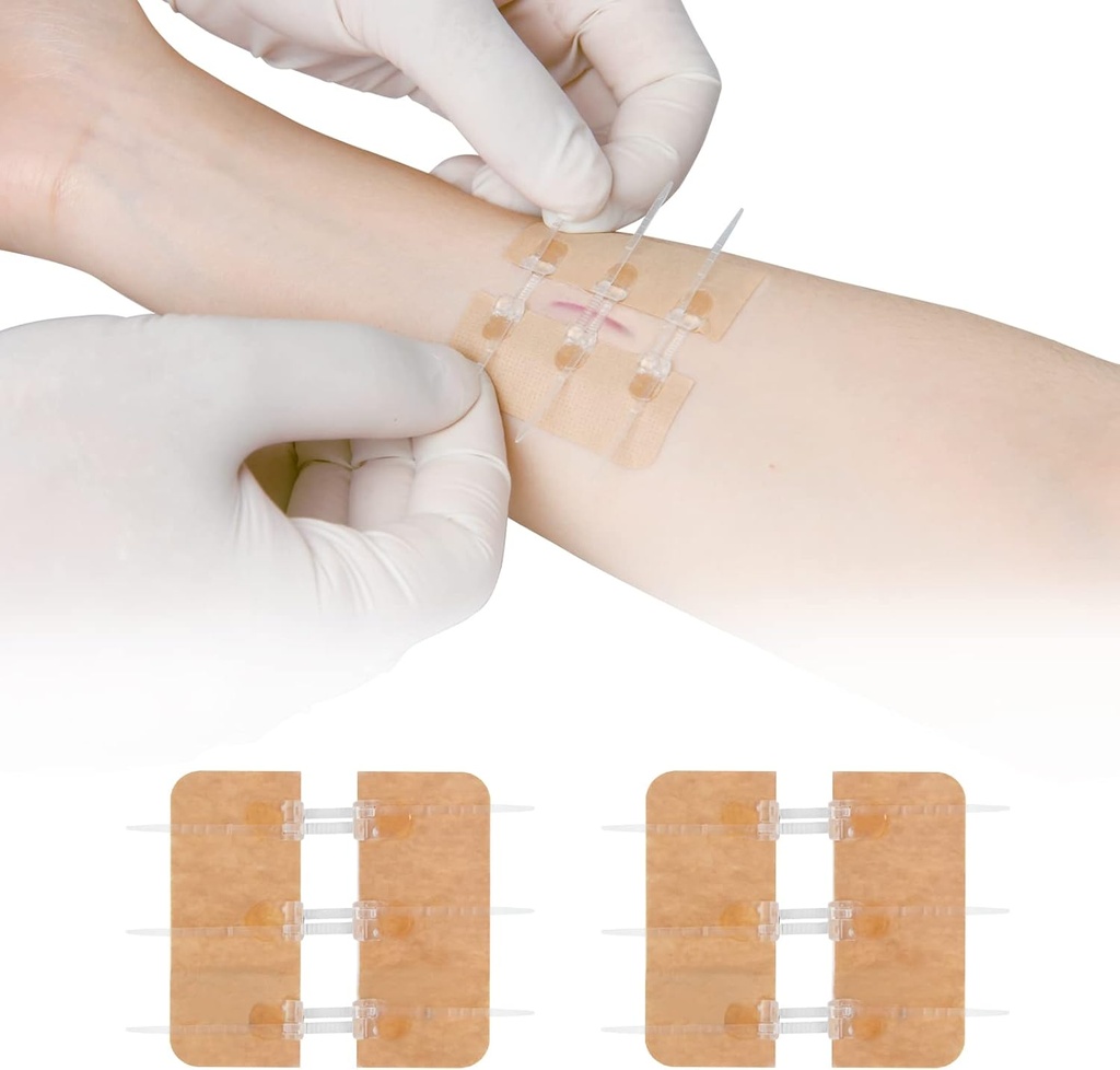 Zip Stitch Repair Repair χωρίς Stitches Butterfly Bandaids Quick Clot - Επείγουσα Λήξη Τραυμάτων Συσκευή 2 Τεμάχια(PU)