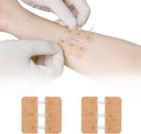 Zip Stitch Repair Repair χωρίς Stitches Butterfly Bandaids Quick Clot - Επείγουσα Λήξη Τραυμάτων Συσκευή 2 Τεμάχια(PU)