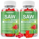 Saw Palmetto Gummies Saw Palmetto Supplement with Pumpkin Seed Oil, Biotin, Prostate Health Supplements for Men, Advanced DHT Blocker, Hair & Urinary Health Support, Raspberry Flavor, 120 Counts