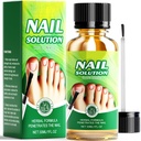 Toenail Fungus Treatment Extra Strength, Extra Strength 25% Undecylenic Acid Toe and Fingernail Fungus Removal, Natural Plant Extracts for Thick, Broken, Discolored, Gentle for All Ages 30ML