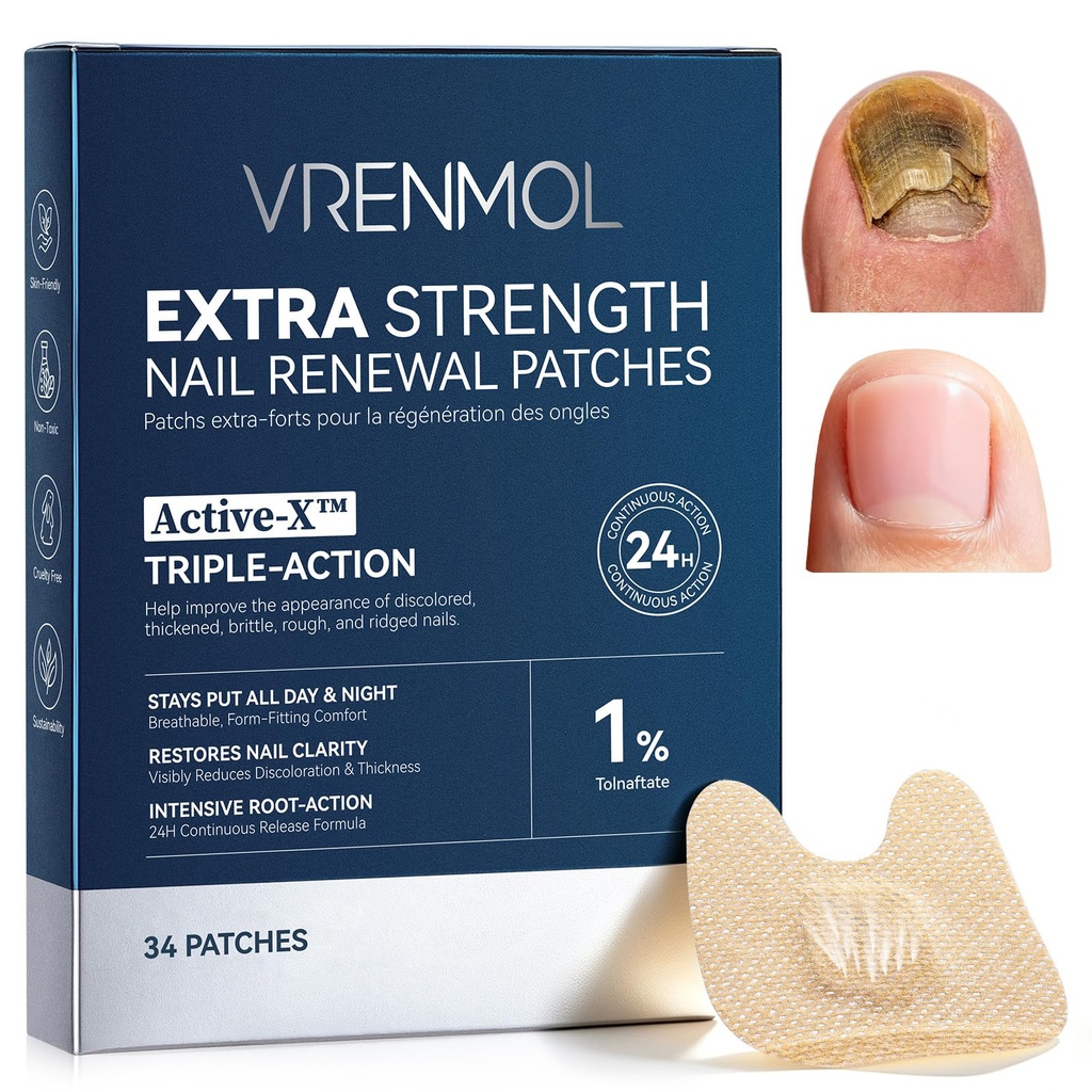Vrenmol Fungal Nail Patches Extra Strength 1% Tolnaftate for Fungus 34PCS | 1% Tolnaftate, 20% Urea, Deep V Contour, Day & Night Release, Waterproof, Residue-Free