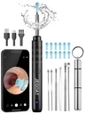 JEGOAT Ear Wax Removal Tool Camera, 1296P HD Otoscope with 6 LED Lights | Soft silicone ear scoops, IP67 waterproof lens, WiFi for iOS & Android, rechargeable, multi-use health inspection, Jet Black
