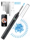 Ear Wax Removal Tool Camera - Ear Cleaner with 1080P HD Camera, FSA HSA Store Eligible, Otoscope with Light, Earwax Removal Kit with 50 Replacement Tips for iPhone, iPad, Android Phones (Black)2