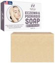 Eczema Soap Bar για το πρόσωπο και το σώμα – Όλη η φυσική δερματίτιδα, Psoriasis θεραπεία για ξηρό Ichy Flaky Skin Relief – Απαλό Αποτοξινωτικό, Θεραπεία, Anti-Itch, Καθαρισμός Skincare Remedy – Eczema Soap Bar